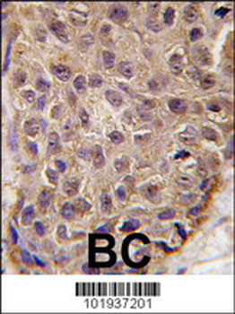 OAS1 Antibody (C-term)