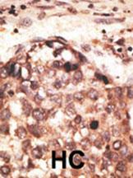 MMP8 Antibody (Center)
