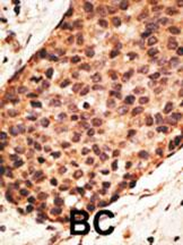 MMP16 Antibody (N-term)