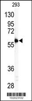 MMP11 Antibody (C-term)