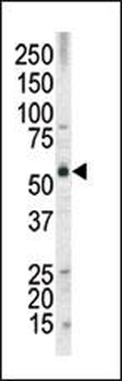 MLLT3 Antibody (N-term H54)