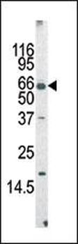 AF9 (MLLT3) Antibody (Center V422)