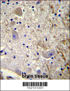 MAGEL2 Antibody (C-term)