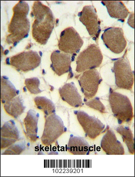LRP3 Antibody (C-term)