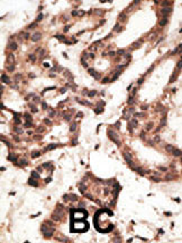 LRP1 Antibody (C-term)