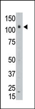 LAF4 Antibody (C-term)
