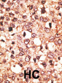 Cry1 Antibody (C-term)