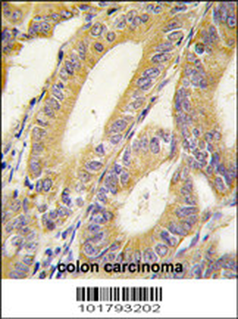 XIAP (BIRC4) Antibody (N-term)