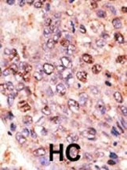 ABCB7 Antibody (C-term)