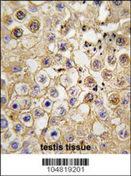 ACE2 (NCOVID/SARS Receptor) Antibody (C-term)