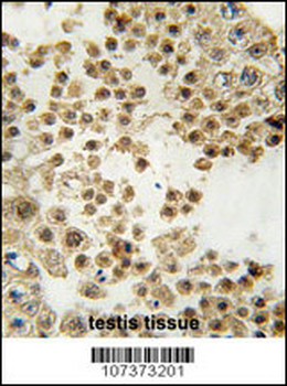 ACE2 (NCOVID / SARS Receptor) Antibody (N-term)