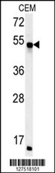 FKBP8 Antibody (Center)