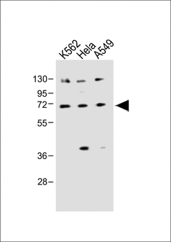 SLC22A4 Antibody (C-term)