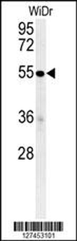 C4BPA Antibody (C-term)