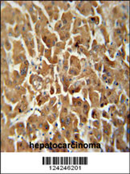 ATP5G2 Antibody (C-term)