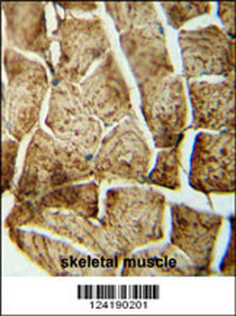SMPD4 Antibody (N-term)