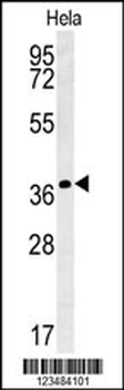 IL24 Antibody (C-term)