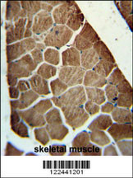 ADSSL1 Antibody (N-term)