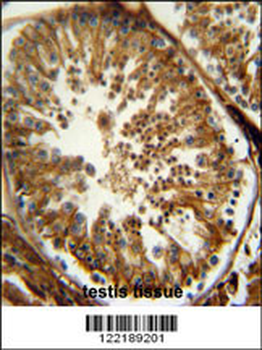 PAOX Antibody (Center)