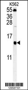 LSM4 Antibody (Center)