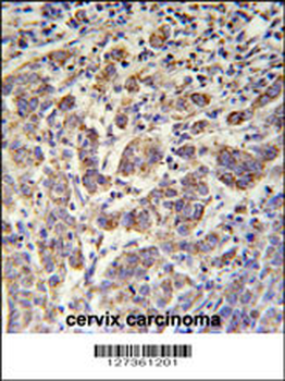 ANKRD57 Antibody (C-term)