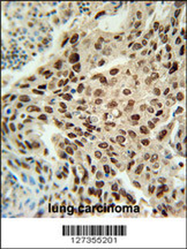 PRNIP Antibody (C-term)