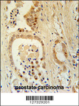 Z385B Antibody (N-term)