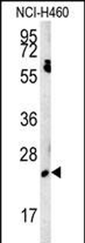 EBPL Antibody (C-term)
