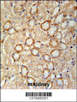 CRUM2 Antibody (C-term)