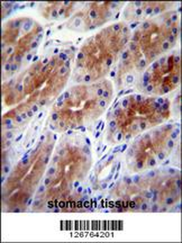 SAMD9 Antibody (C-term)