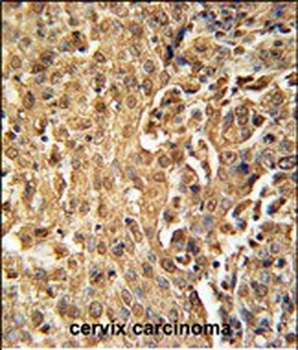 ZC3HAV1 Antibody (C-term)