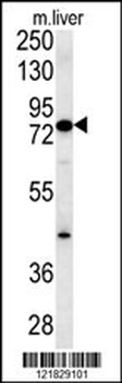 MCCC1 Antibody (Center)