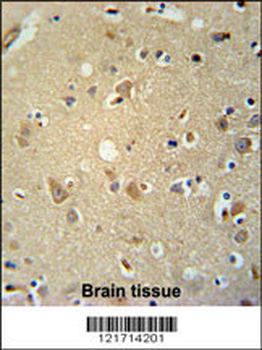P2RX7 Antibody (C-term)
