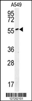ALG10B Antibody (C-term)