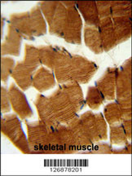 PREPL Antibody (C-term)