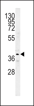 SRD5A2 Antibody (Center)
