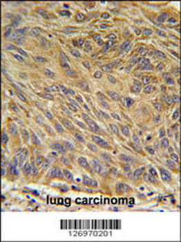 CD99L2 Antibody (Center)