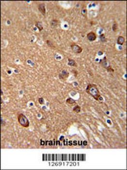 SYT13 Antibody (N-term)