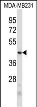 PRB2 Antibody (C-term)