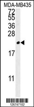 TREM2 Antibody (N-term)