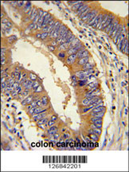 DHX58 Antibody (N-term)