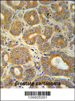 CRABP1 Antibody (C-term)