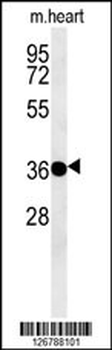 PTAFR Antibody (C-term)