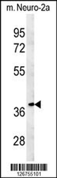 TNFAIP1 Antibody (C-term)