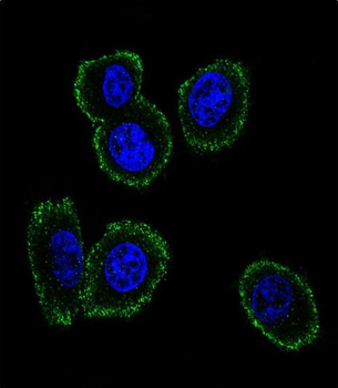 NMB Antibody (Center)