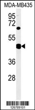 SH2D2A Antibody (Center)