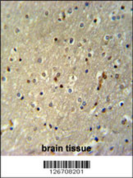 TTC26 Antibody (C-term)