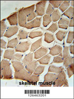 NPAL3 Antibody (N-term)