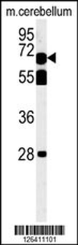 TBKB1 Antibody (N-term)