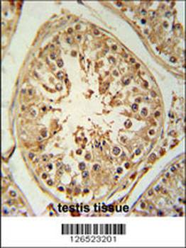 ZBTB5 Antibody (N-term)